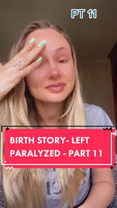 PART 11 #paralyzed after #childbirth #birthstory #mother #nervedamage  #GetCrocd