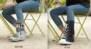 Needless to say i could not drive. Which Would You Rather Wear After Ankle Surgery Foot Surgery Or Toe Surgery Hide That Aircast Or Walking Boot And Flaunt I Medical Boot Boots Air Cast Boot