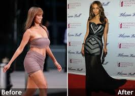 Pin On Weight Loss