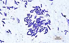 Paenibacillus popilliae, which infects larvae of the japanese beetle, popillia japonica, was the first microbial control agent registered in the us for use against an insect. Bacillus Wikipedia