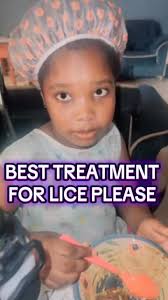What’s the best treatment for lice please