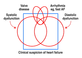 Image result for Systolic Dysfunction