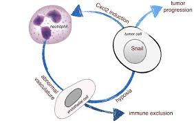 Ça bouge dans pour le cancer du poumon!! Des Cellules Immunitaires Qui Aident Les Tumeurs Epfl