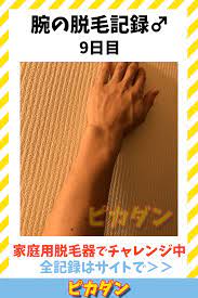 腕脱毛の記録9日目 毛深い30代男が家庭用脱毛器で挑戦中 脱毛 脱毛器 腕 脱毛