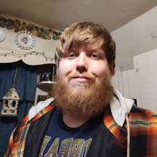 TJ Dillashaw can't raise his left arm after multiple shoulder surgeries 😳  "It doesn't hurt, but it doesn't work"