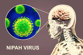 A nipah virus infection is a viral infection caused by the nipah virus.2 symptoms from infection vary from none to fever, cough, headache, shortness of breath, and confusion.12. Nipah Symptoms Outbreaks And How The New Scary Virus Is Transmitted Italy24 News English