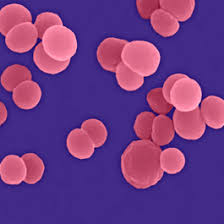 Hsv, cmv, herpes b virus. ØªØ§Ø±ÙŠØ® Ø§Ù„ØªØ·Ø¹ÙŠÙ…Ø§Øª Ø§Ù„ØªÙ‡Ø§Ø¨ Ø§Ù„Ø³Ø­Ø§ÙŠØ§ Ø¨Ø§Ù„Ù…ÙƒÙˆØ±Ø§Øª Ø§Ù„Ø³Ø­Ø§Ø¦ÙŠØ©