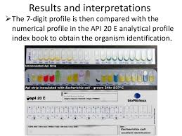 Api 20 E