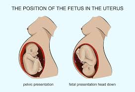 Different Positions Of Baby In The Womb