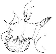 Content adapted from the who basic emergency care course. Syahrul Kamil On Twitter Head Tilt And Chin Lift Drcab Bls Http T Co Q0bwntirsf