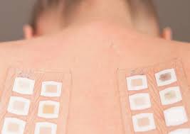Secondo le ultime stime, infatti, in europa il 20% circa della popolazione è allergica al nichel, mentre in italia si arriva al 32,1%, con un rapporto tra donne e uomini di 3 a 1. Come Capire Se Si E Allergici Al Nichel Sintomi E Test Specifici