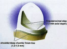 Sehingga, kesehatan gigi sebelah tidak terganggu dan tetap. Schematic Drawing Of Anterior Abutment Tooth Preparation For The Download Scientific Diagram