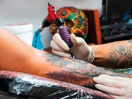Do you have a yeast infection? Tattoo Causes Tissue Death In Dubai Resident S Arm Community Gulf News