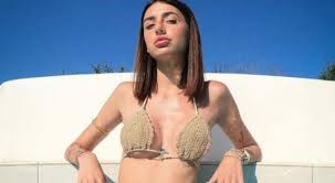 Michelle Comi in ospedale: «Intervento riuscito, sono tornata vergine. Il  motivo? La mia prima volta è stata troppo superficiale»