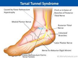 Pin On Foot Ankle