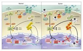 03.09.2021 · prostate cancer develops when the rates of cell division exceed those of cell death, leading to uncontrolled tumor growth. Prostate Cancer Nejm