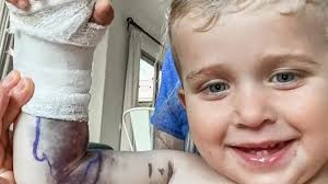 Pais ficam com conta de R$ 1,8 milhão em hospitais após filho ser picado  por cascavel