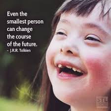 Down Syndrome Awareness