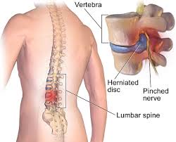 Image result for vyhřezlá ploténka