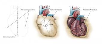 Image result for Pericardium