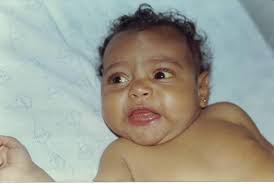 Colestase neonatal: Principais causas & abordagem diagnóstica