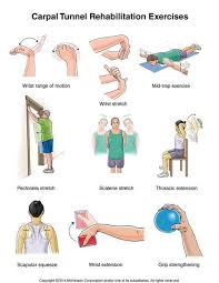 Summit Medical Group Carpal Tunnel Syndrome Exercises Rehabilitation Exercises Hand Therapy Carpal Tunnel Surgery