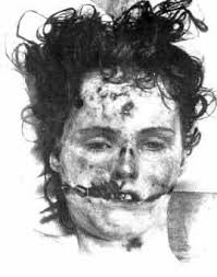 The victim is then kicked very hard in the nuts or in the case of a woman a leg is broken and as the victim screams the cuts rip creating the chelsea smile. Apres Moi Le Deluge Blankett A Glasgow Smile Also Known As A