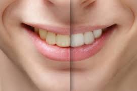 But there are ways to make sure that they learn while they watch! What Causes Discolored Teeth And Is There Any Way To Cure Or Prevent Staining Tufts Now