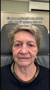 Alicha Harmonização