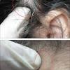 A bacteria can invade the ingrown hair cyst which can later leads to a discharge of either yellow or green in a more consistency way. Https Encrypted Tbn0 Gstatic Com Images Q Tbn And9gctzdgnsymfqfnrcqhn7rtehzmfnshddshaqcwh401aljb3oe6at Usqp Cau