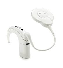 Image result for Cochlear Implant