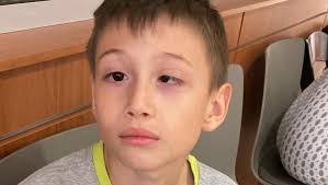 Fundraiser by Jennifer Plata : 1dolar para ayudar a la recuperación de  Samuelito