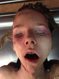 Young blonde female in morgue | theYNC