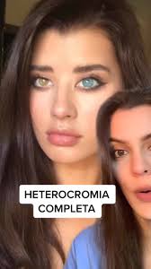 O que é Heterocromia? Descubra Fatos Curiosos!
