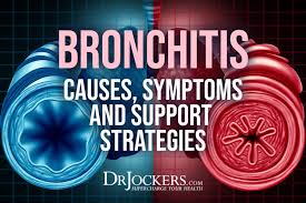 We did not find results for: Bronchitis Causes Symptoms And Support Strategies Drjockers Com