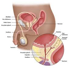 But hearing the words can still be scary. Prostate Cancer Treatment Surgery In India