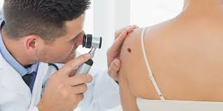 Monika arenbergerová s manželem na snímku z roku 2016. Melanomu Stale Pribyva Jak Se Branit Rakovine Kuze Dama Cz