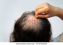 Fwiw, premature gray is a whole lot more attractive than dyed hair. Shutterstock Puzzlepix