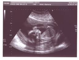 So many ways to personalize a fake ultrasound: Pulling The Trigger Young Clergy Women International