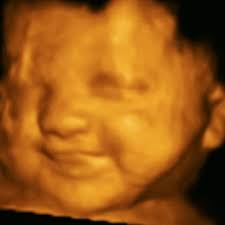 🤰Wonderful look at baby at 28weeks 5 day!!! #profile #preciousbaby  #Jacksonville4dfetalphoto