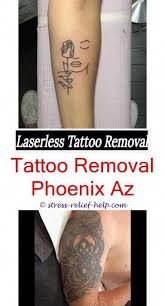 The cost of laser tattoo removal depends on several factors, including the size of tattoo and the number of treatments it will require. Low Cost Laser Tattoo Removal How Much Does Tattoo Removal Cost In South Africa How Long To Wait To Remove A T Tattoo Removal Tattoo Removal Cream Laser Tattoo