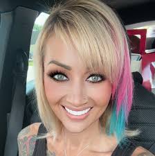 When does swelling typically start to go down?