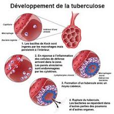 La legionella n'est pas transmissible d'homme à homme. Legionellose Symptomes Traitement Definition Docteurclic Com