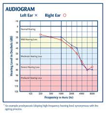 29 Perspicuous Hearing Age Chart