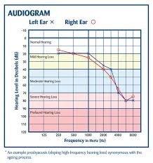 29 perspicuous hearing age chart