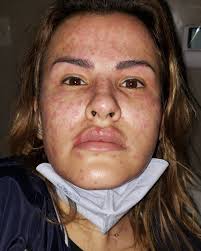 Les hago un resumen de lo que me paso y realmente quise compartir con  ustedes desde el comienzo. Seguro que algunos no estarán tan de acuerdo con  que exponga mi vida, pero