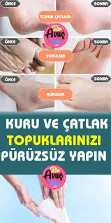 Pin By Hatice Emengen On Cilt Urunleri In 2020 Yoga Live Lokai Bracelet Healthy
