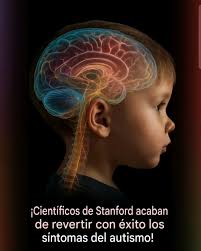Un equipo de Stanford acaba de revertir síntomas del autismo al dirigir su  atención a una región cerebral hasta ahora poco estudiada. En un estudio  innovador, investigadores de la Stanford Medicine lograron