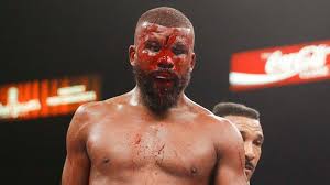 His face was a bloody mask. Boxer Suffers Horror Cut During Undercard Of Pacquiao S Wba Welterweight Title Defence The Standard Sports