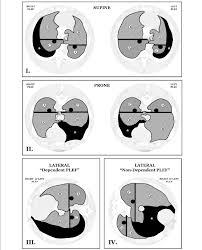 The liver is situated in the upper right and left quadrants. Schematic Images In All Horizontal Positions And Their Respective Download Scientific Diagram